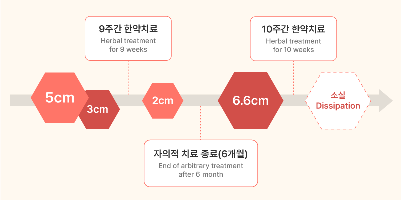 통계