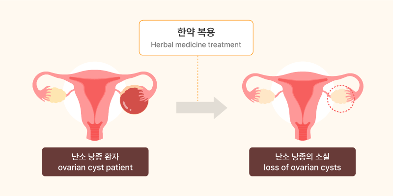 통계